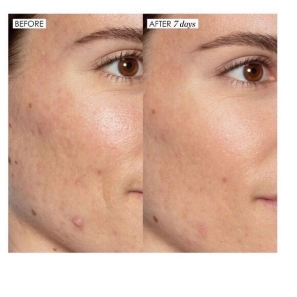 $5 🌙‎ Sunday Riley Good Genes Lactic Acid Treatment - Picture 4 of 9